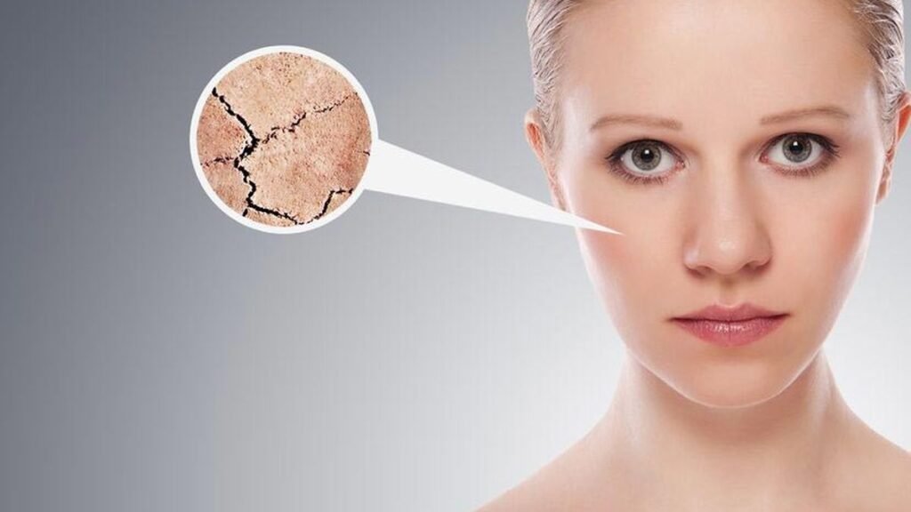 Ketika kulit mengalami dehidrasi, tanda yang dimunculkan seperti kerutan, garis halus, hingga bisa menimbulkan jerawat dan iritasi kulit.