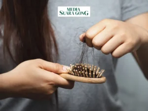 Gaes !!! Ini 6 Tips Atasi Rambut Rontok