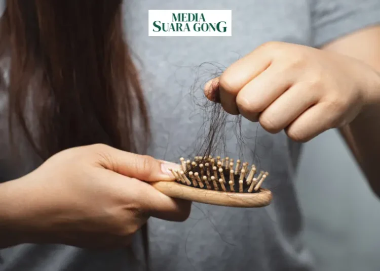 Ini 6 Tips Atasi Rambut Rontok (Media Suaragong)