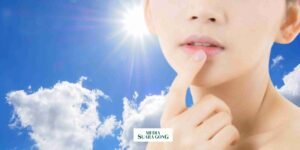 Gaes !!! Tips Ampuh Atasi Bibir Pecah-Pecah di Musim Kemarau