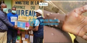 Gaes !!! WHO Deklarasikan Keadaan Darurat Kasus Cacar Monyet atau MPOX