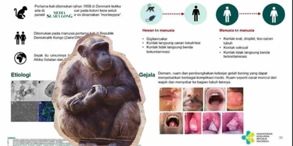 Gaes !!! MPOX :  Pria Penyuka Sesama Jenis Paling Rentan