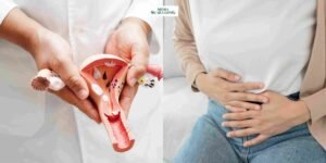 Gaes !!! Sering Diabaikan, Begini Mengerikannya Penyakit Kista