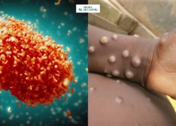 Ditemukan 3 Kasus Mpox yang terjadi di Luar Afrika