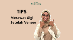 Gaes !!! 7 Tips Merawat Gigi Setelah Veneer Biar Tetap Kece
