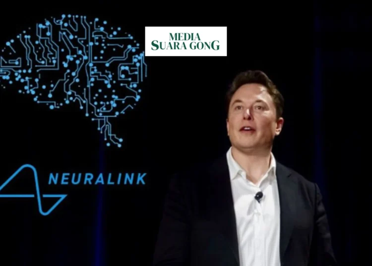 Ambisi Neuralink Implan Organ Dengan Blindsight