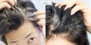 Gaes !!! Atasi Rambut Beruban di Usia Muda
