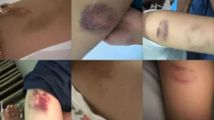 Gaes !!! Viral di Sosmed, Kasus Kekerasan Seksual Mahasiswa Binus Malang