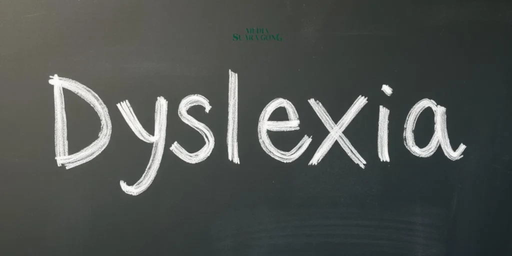 Gaes !!! Disleksia: Tantangan dan Solusi untuk Anak dengan Kesulitan Belajar