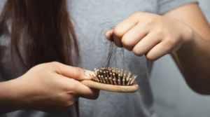 5 Tips Ampuh Atasi Rambut Rontok Parah