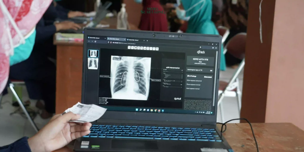 Ini Kelompok Orang yang Beresiko Tinggi Tertular TBC