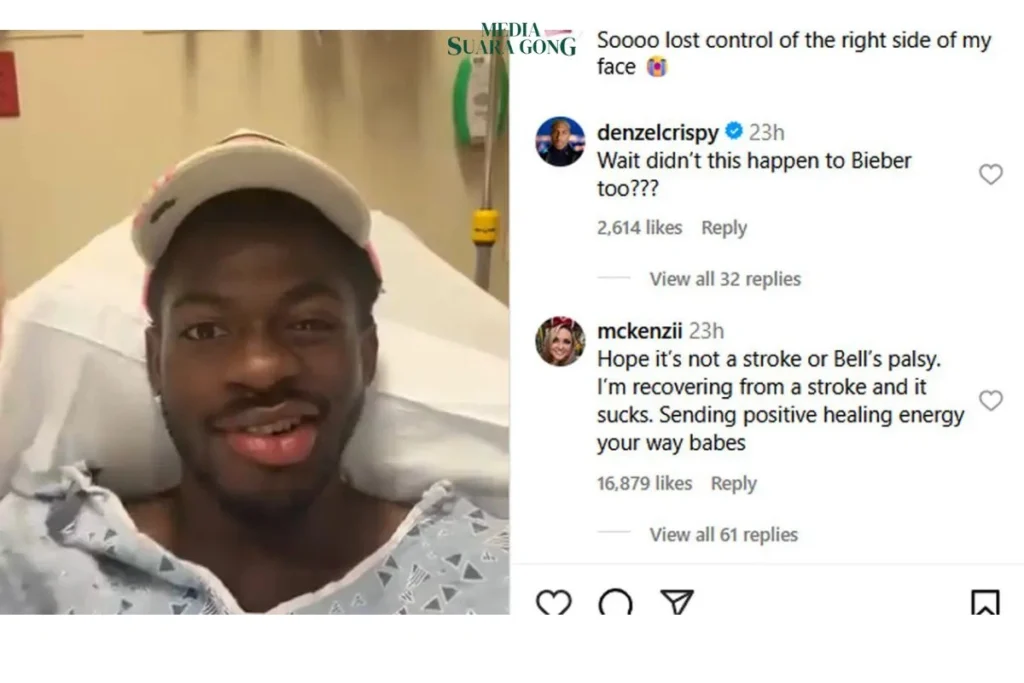 Rapper asal Amerika Serikat, Lil Nas X, mengungkapkan kondisi kesehatannya yang mengejutkan yang membuatnya kesulitan tersenyum atau berkedip