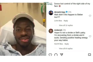 Lil Nas X Alami Kelumpuhan Wajah Sebelah, Sulit Tersenyum