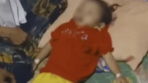 Kemenkes Buka Suara soal Kasus Bocah Sukabumi Meninggal karena Cacing