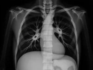 Dinkes Malang Tegaskan Komitmen Tekan Kasus TBC Lewat Layanan Gratis dan Edukasi